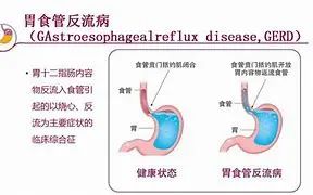 健身 人体四大营养素_人体营养素是什么意思_人体营养素比例图